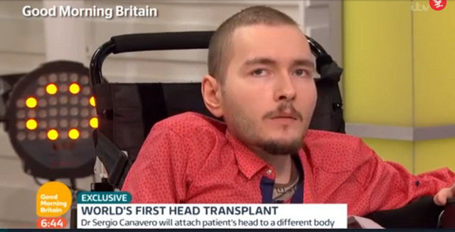 Chuyên gia phẫu thuật Sergio Canavero tiết lộ trên kênh truyền hình.