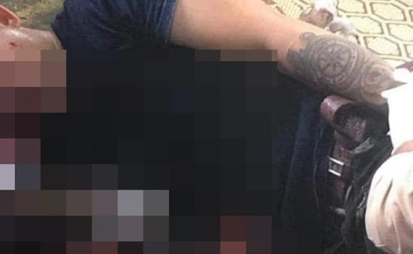 Người đàn ông nguy kịch sau tiếng nổ lớn trong quán cà phê (Ảnh: T.H)