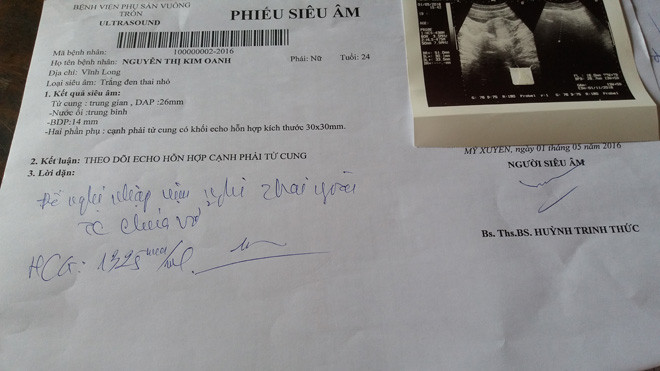 Phiếu siêu âm của bệnh viện Vuông Tròn