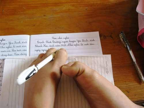 Hãy thắp sáng ước mơ cho cô gái khuyết tật 