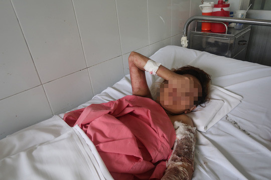 Chị Nguyễn Thị H. liên tục lau nước mắt khi kể về cuộc đời bất hạnh của mình.