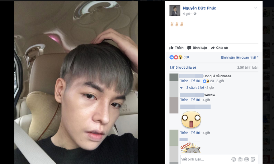 Đức Phúc tự tin chia sẻ hình ảnh về nhan sắc thật sau phẫu thuật thẩm mỹ.