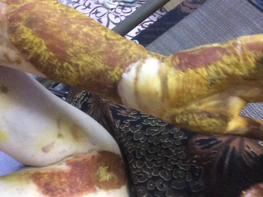 Nữ sinh trường THPT Phan Đình Phùng (Hà Nội) bị bỏng nặng sau giờ thực hành thí nghiệm ở trường