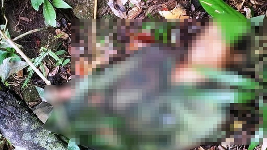 Nạn nhân bị trúng 13 mảnh đạn ria vào vùng tay và ngực làm thủng phổi dẫn đến tử vong. Ảnh: Q.T