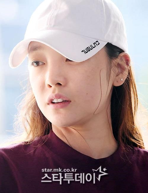 Goo Hara suy sụp tinh thần sau vụ kiện hành hung với bạn trai.