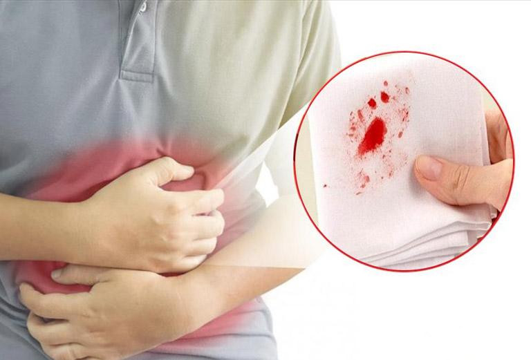 Bất ngờ chảy máu từ những vị trí này, rất có thể bạn đã bị ung thư