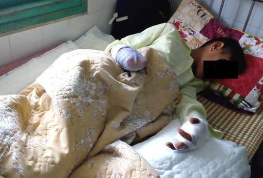 Cháu Th. đang điều trị tại bệnh viện 