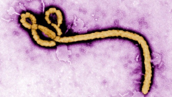 Ebola là hậu quả của chiến tranh sinh học?
