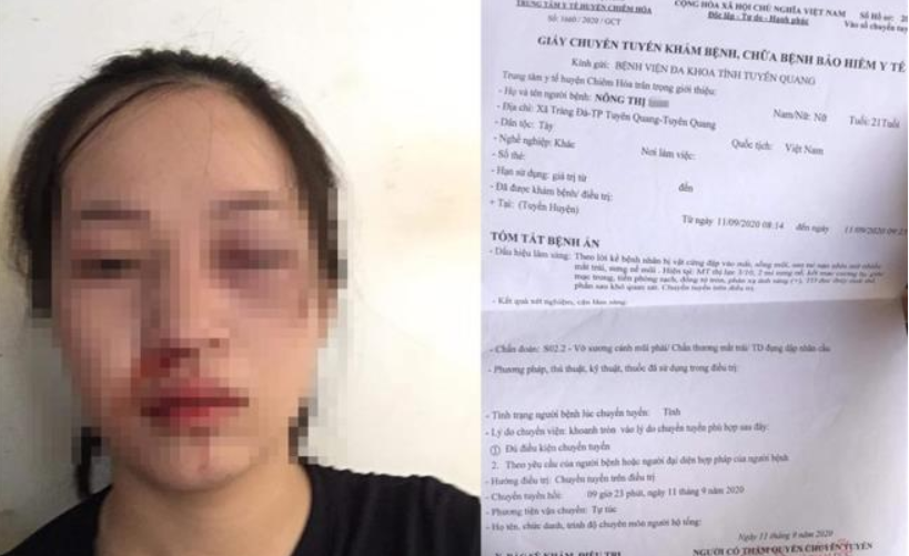 Chị Nông Thị Mai tố bị CSGT gây thương tích.