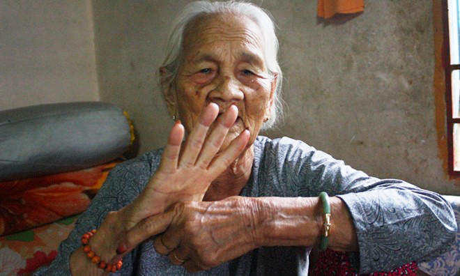 Cụ Bài kể lại lục bị tên Tú bẻ ngược tay của mình. 