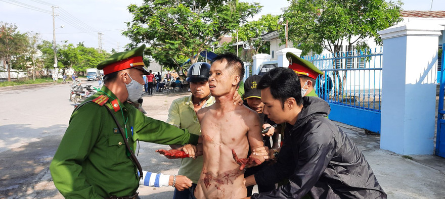 Công an khống chế đối tượng ngáo đá tự cứa cổ, tay mình. Ảnh L. V