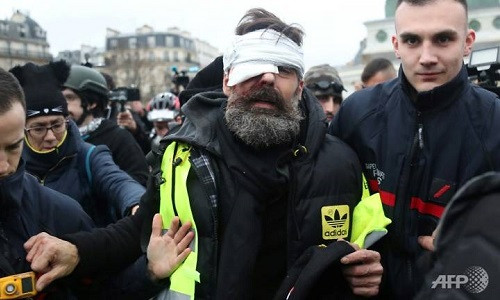 Jerome Rodrigues bị thương ở mắt trong cuộc biểu tình ngày 27/1. Ảnh: AFP