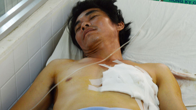 Nghi phạm Sơn đã qua cơn nguy kịch.