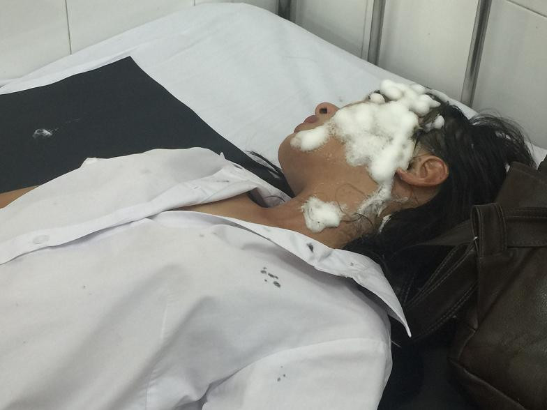 Sinh viên V.T.H đang cấp cứu tại bệnh viện trong tình trạng bỏng nặng ở mắt. Ảnh L.V