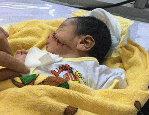 Bé trai hiện đã bình phục và được điều trị tại bệnh viện 