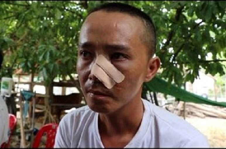 Nạn nhân kể lại 3 lần bị truy sát khiến cha chết, con trọng thương