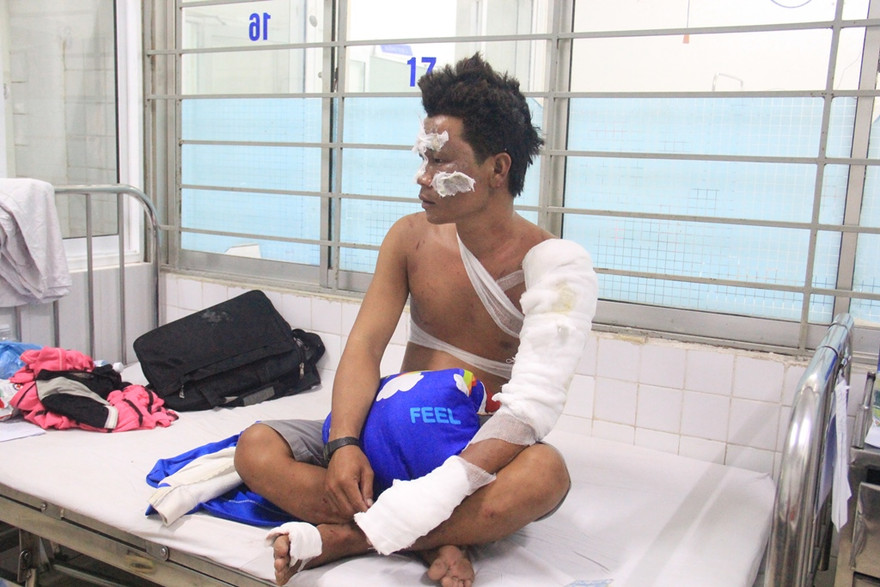 Vụ nổ tàu cá 14 người thương vong: Nhiều ngư dân bỏng trên 30%