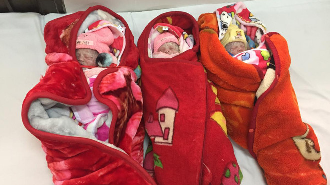 Ca sinh ba thành công đầu tiên ở Lạng Sơn (ảnh do BV Lạng Sơn cung cấp)