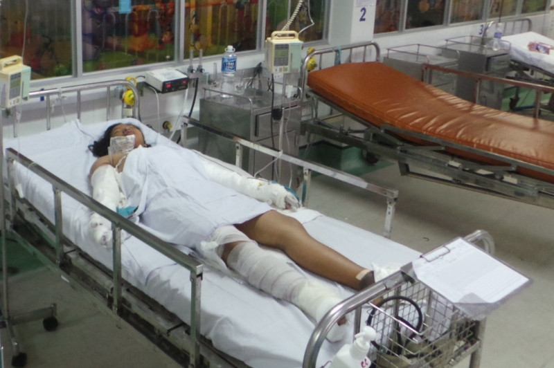 Bé L. được theo dõi hồi sức cấp cứu tại khoa bỏng tạo hình Bệnh viện Nhi đồng 1. Ảnh: Quốc Ngọc