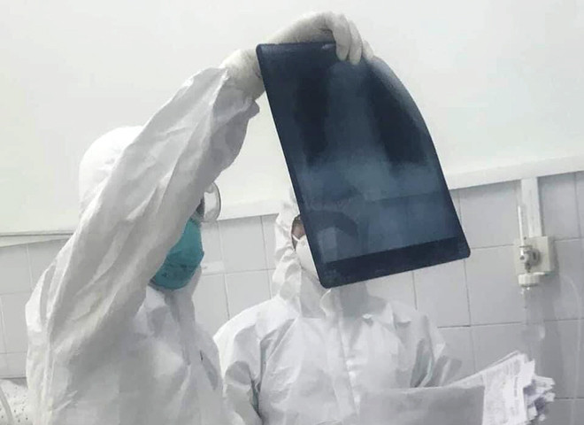 Kiểm tra phim chụp Xquang phổi cho bệnh nhân mắc COVID-19. Ảnh: TS -BS Lương Quốc Chính