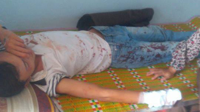 Anh Dũng hiện đang được điều trị tại bệnh viện