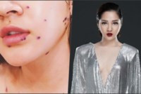 Bảo Anh - 'Tình tin đồn' của Bùi Tiến Dũng nhập viện vì kiệt sức