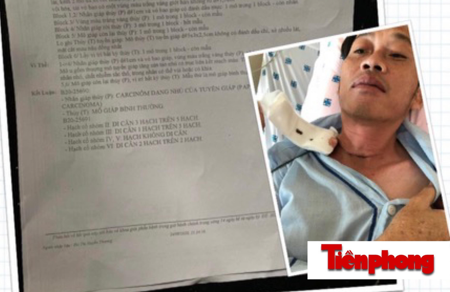 Hoài Linh tiết lộ phải phẫu thuật K tuyến giáp cách đây vài tháng