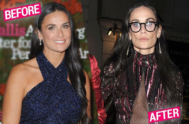 Hình ảnh hiện tại gây sốc của Demi Moore (bên phải) so với cô trước đây