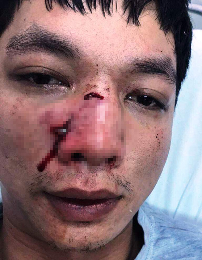 Nạn nhân Nguyễn Văn Lương