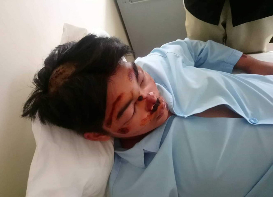 Học sinh T. dính nhiều vết thương tích nghi do bạn học cùng trường đánh, chém, hành hung 