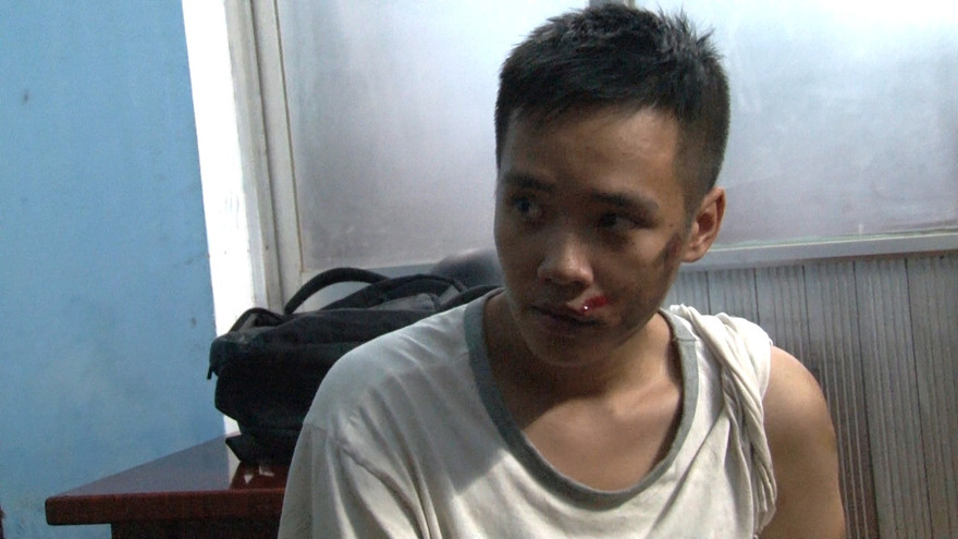 Đối tượng cướp giật Phạm Bá Quang Hiếu với khuôn mặt thương tích, trầy xước do gặp nạn khi thực hiện một phi vụ cướp điện thoại người đi đường tại Huế.