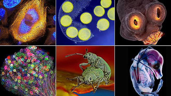 Công bố những ảnh chụp bằng kính hiển vi kỳ thú, bí ẩn nhất năm 2017