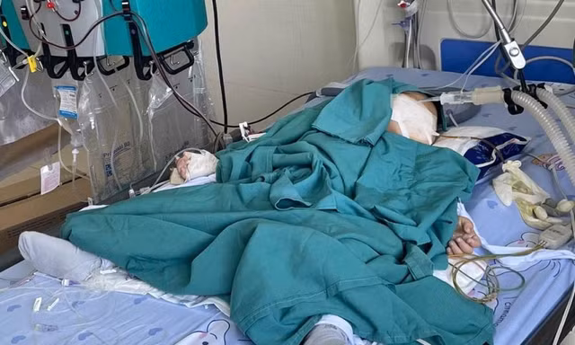 Nuốt nhầm hóa chất thí nghiệm, bé 2 tuổi nhập viện lọc máu