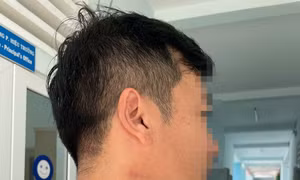 Mới nhất vụ thầy giáo bị đồng nghiệp bóp cổ giữa sân trường ở Đắk Lắk