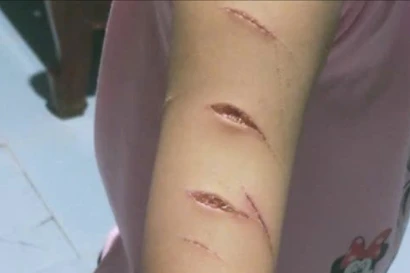 Học sinh lớp 5 ở Cà Mau bị chị họ dùng dao cắt giấy rạch nhiều nhát