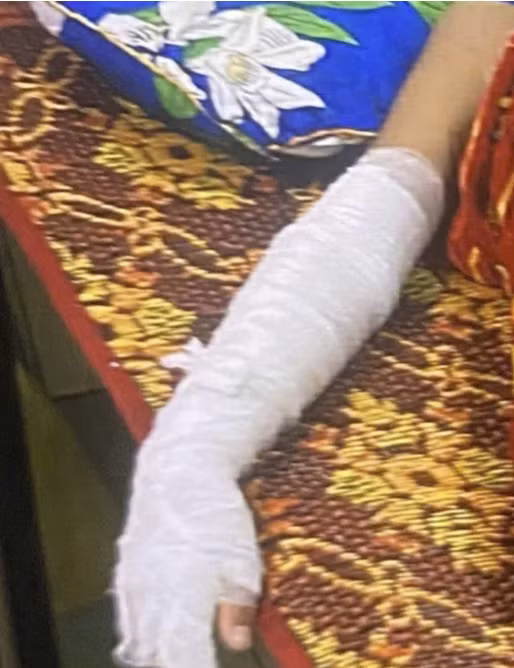 bong-nang-do-vat-la-phat-no-1.png