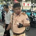 NÓNG 8/8: Phân định pháp lý vụ một trung tá CSGT bị thanh niên người Nga tấn công
