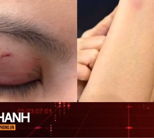 TIN NHANH: Luật sư nhận định vụ ca sĩ Trung Quân Idol bị tố đánh phụ nữ