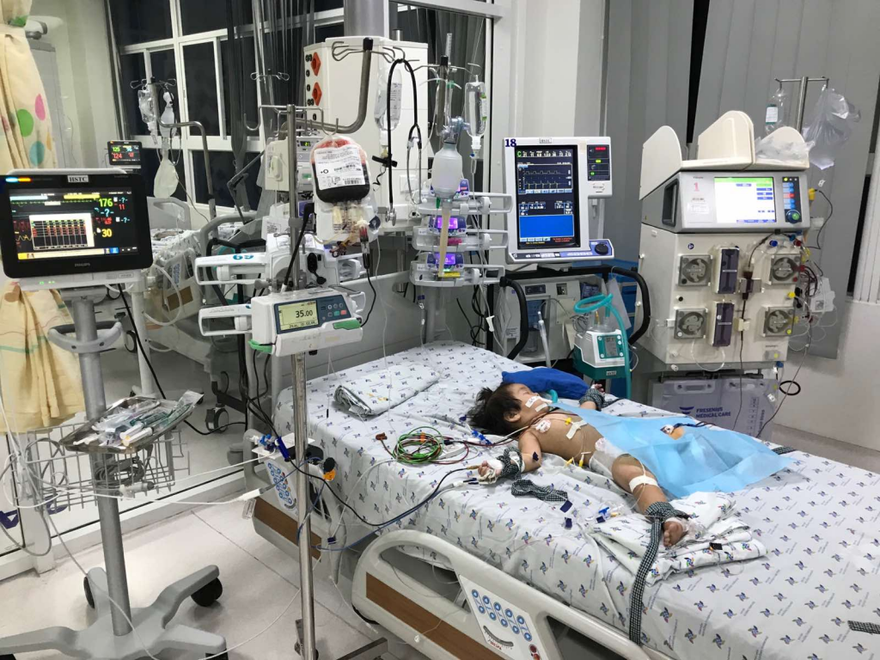 Bệnh nhi mắc tay chân miệng biến chứng nặng được lọc máu liên tục (ảnh: BVCC)