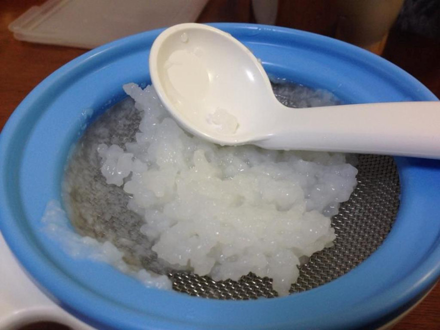 Tưởng bé ăn dặm hóc xương, bác sĩ gắp ra vật không ngờ