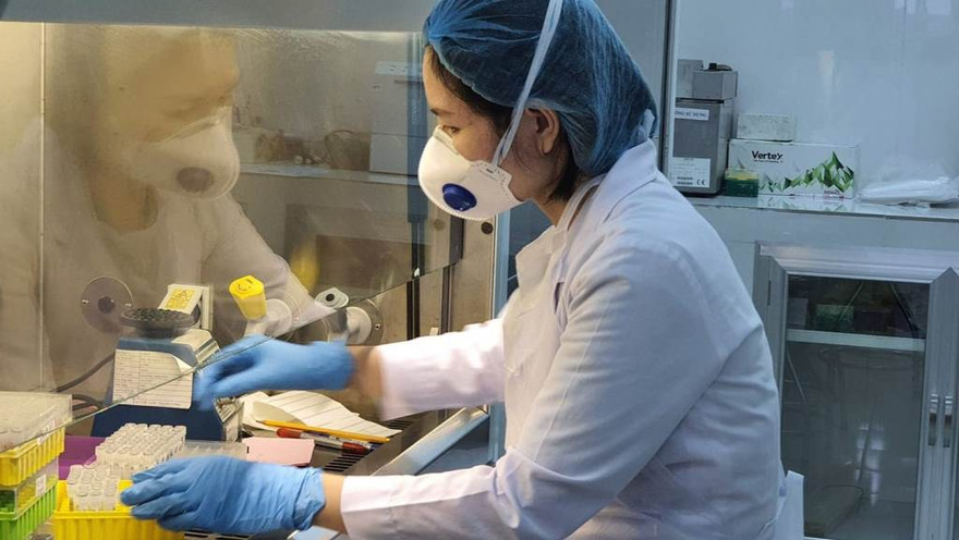 Xét nghiệm COVID-19 (ảnh: HCDC)