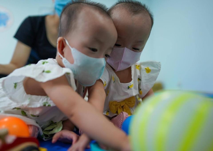 Trúc Nhi - Diệu Nhi chuẩn bị xuất viện sau 2 tháng tách dính