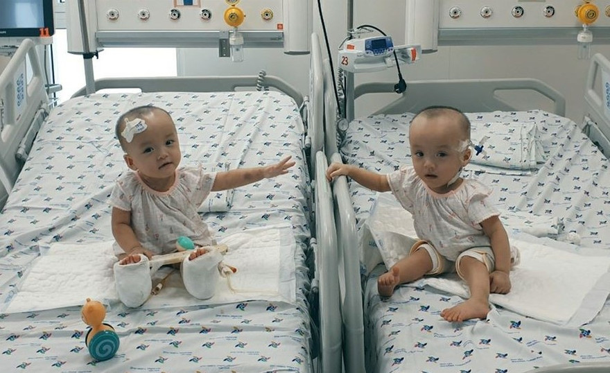 Lần đầu tiên sau tách rời, Trúc Nhi - Diệu Nhi được chạm tay nhau (Ảnh:BVCC)