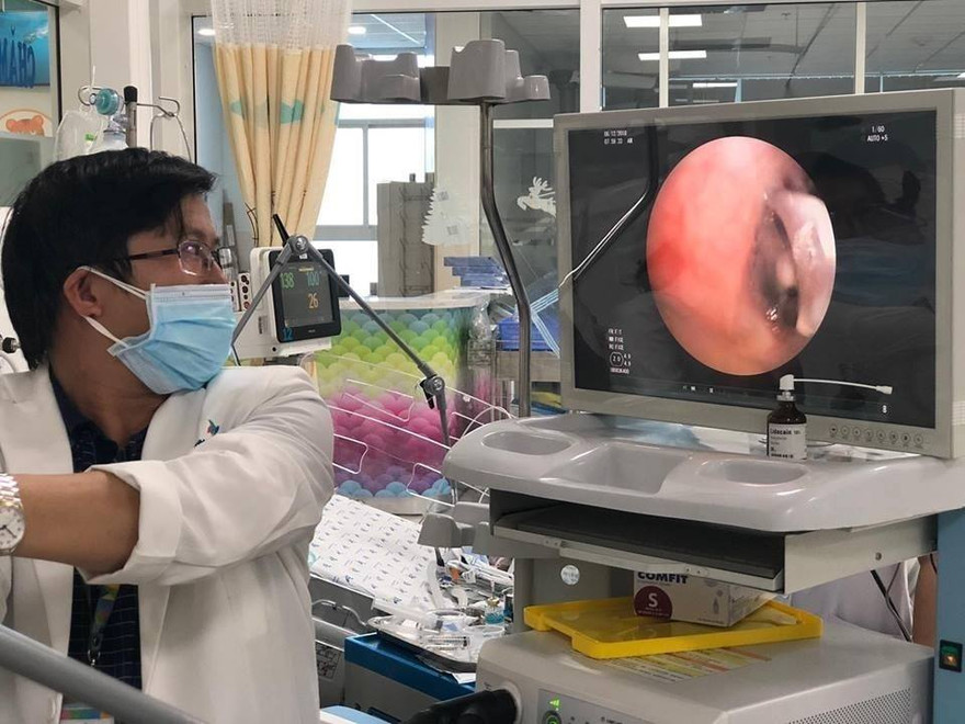 TS.BS Trịnh Hồng Nhiên đang nội soi gắp dị vật cho bệnh nhi (ảnh: BVCC)