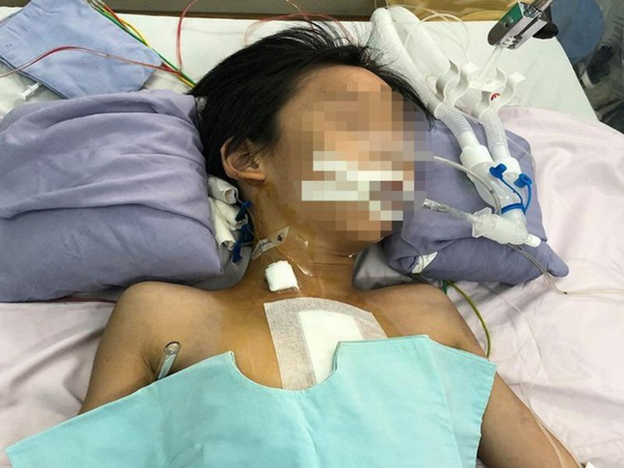 Bệnh nhi thủng tim đã tỉnh táo (ảnh: BVCC)