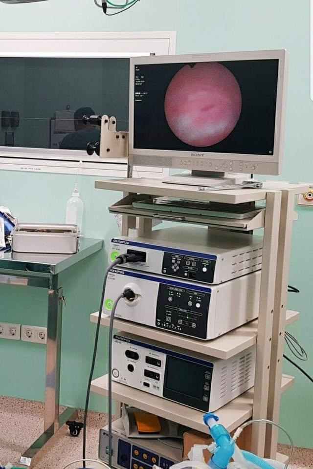 Bác sĩ BV Nhi đồng Thành phố gặp dị vật mắc kẹt cho bệnh nhi (ảnh: BVCC)