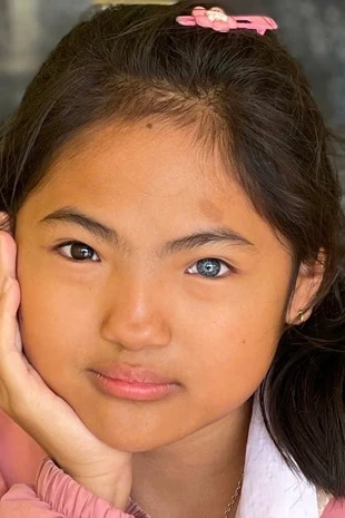 Cô học trò nhỏ có đôi mắt "âm dương".