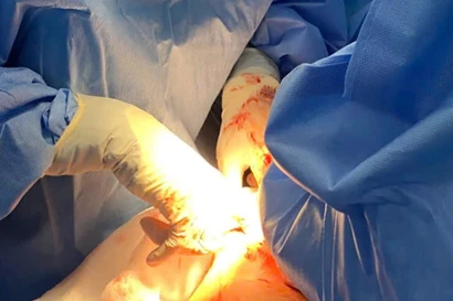 Mẹ con thai phụ lâm nguy vì bệnh nguy hiểm dễ nhầm với thai nghén