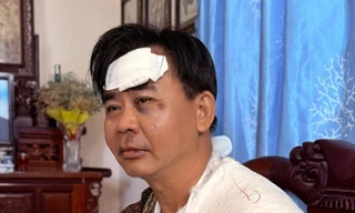 Tình trạng nghệ sĩ Chánh Thuận sau tai nạn xe 