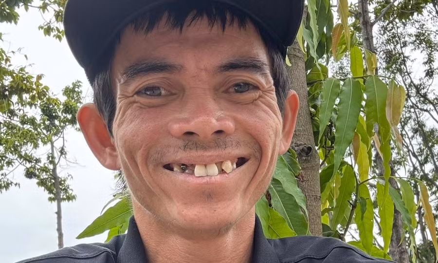 Tình trạng chàng trai chăn bò từng nổi tiếng toàn cầu